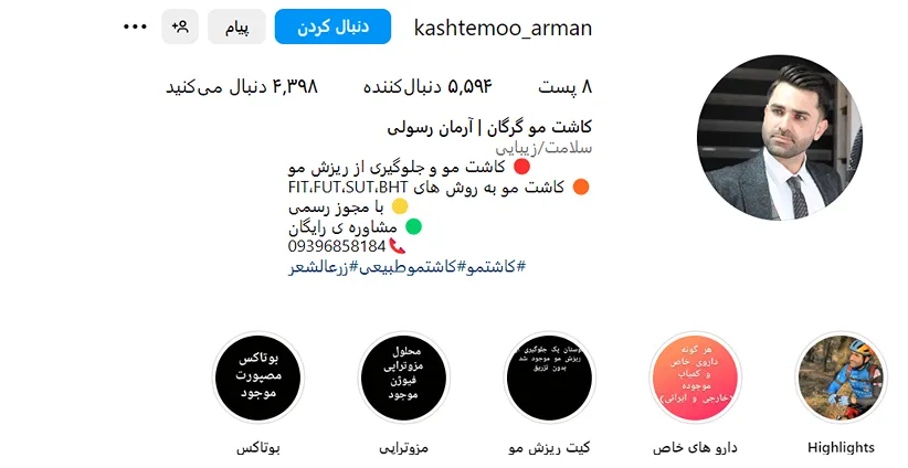 کاشت مو در گرگان توسط بهترین متخصصین و مراکز کاملا قابل انجام است