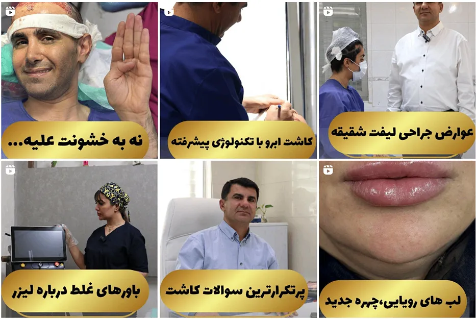 کلینیک ارشیا یکی از بهرتین کلینیک کاشت مو در شیراز است