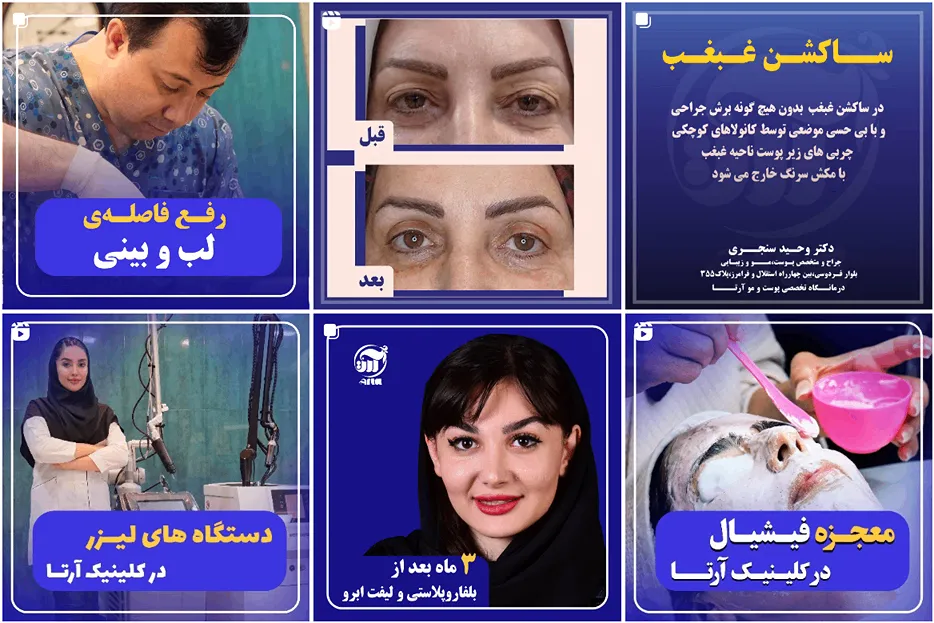 کاشت مو مشهد اقساطی در کلینیک آرتا قابل انجام است