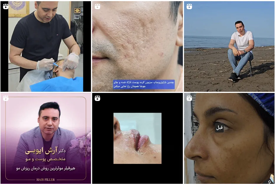 تصویر یکی از بهترین مراکز کاشت مو در اهواز را مشاهده میفرمایید.