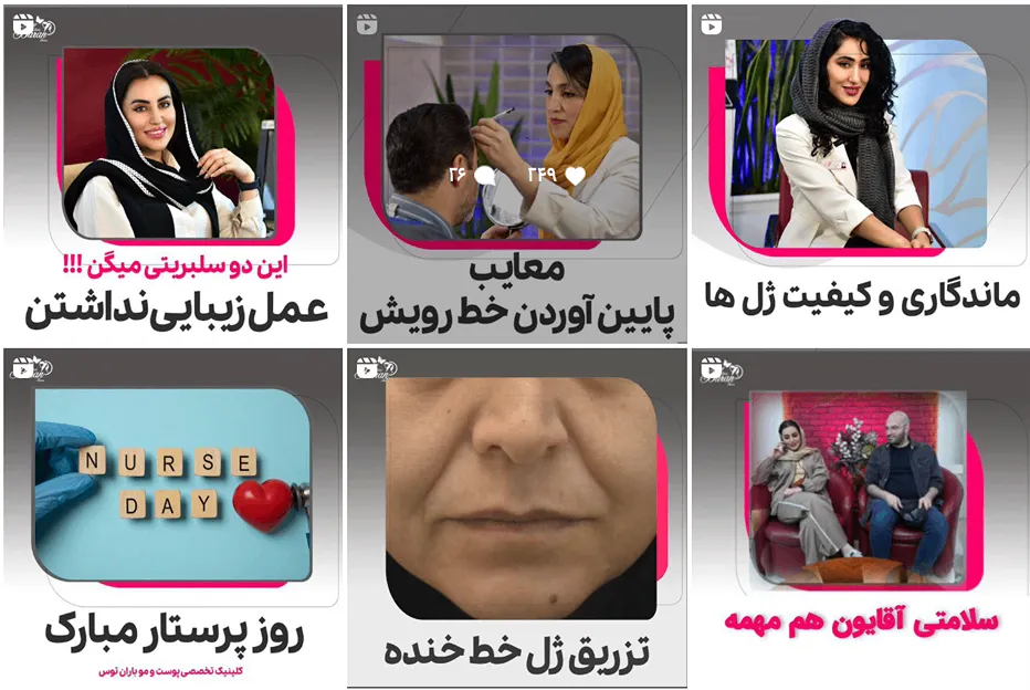 نمونه کار بهترین دکتر کاشت مو در مشهد را مشاهده میفرمایید.