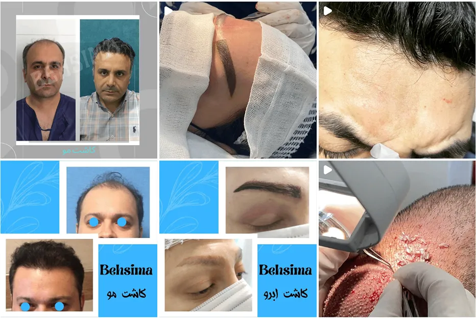 کلینیک به سیما یکی از بهترین کلینیک کاشت مو شیراز است