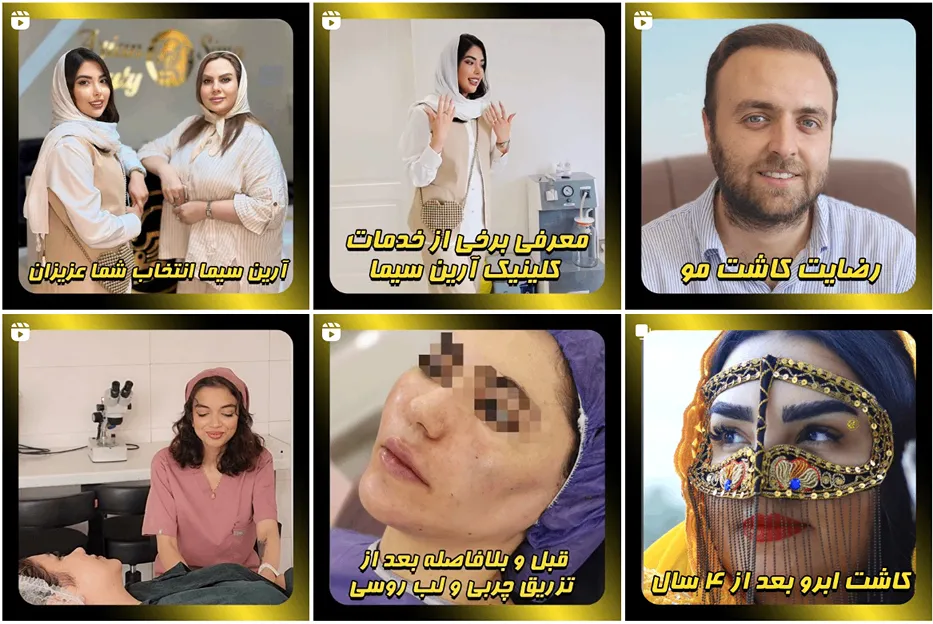 کلینیک آرین سیما از بهترین مراکز کاشت مو در تهران است