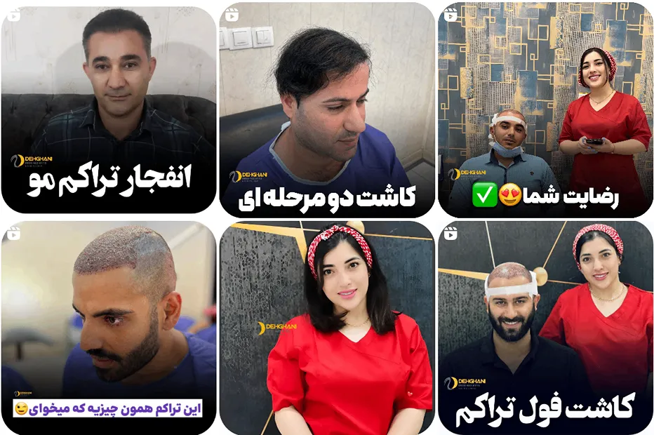 کات مو شیراز توسط نازنین دهقانی کاملا قابل انجام است