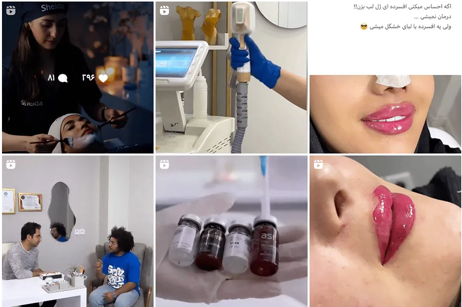 تصاویری از کلینیک زیبایی النو یکی از بهترین کلینیک کاشت مو بجنورد مشاهده میفرمایید.