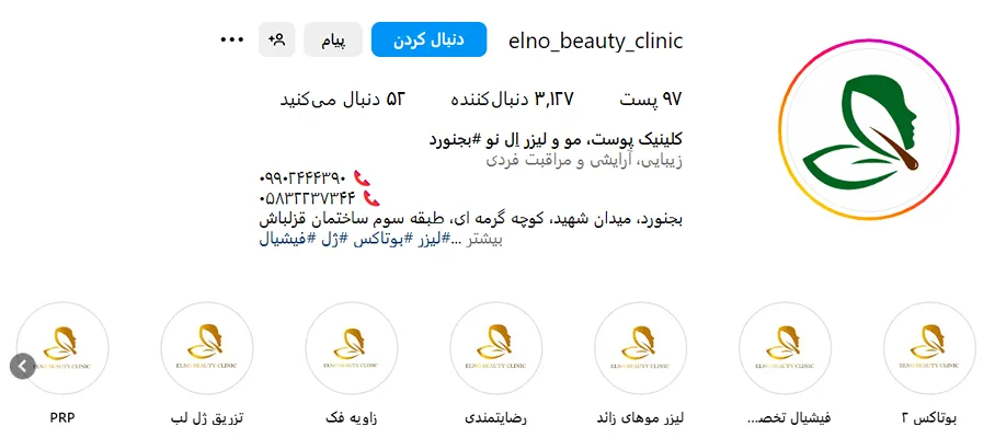 کلینیک ال نو از بهترین کلینیک کاشت مو بجنورد است