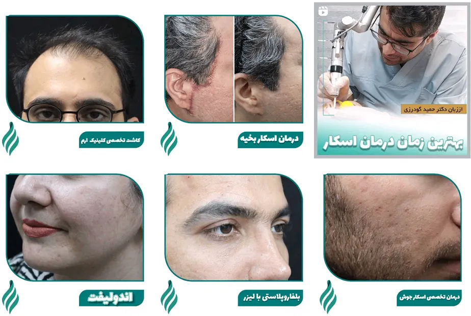 کلینیک ارم یکی از بهرتین کلینیک زیبایی در شیراز است