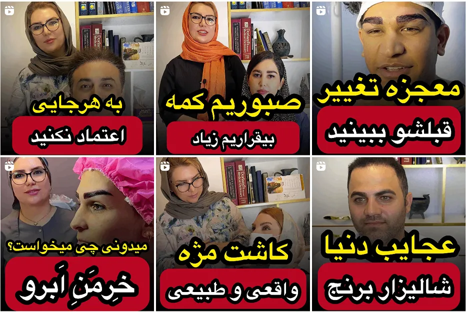 کلینیک گلبان از بهترین کلینیک کاشت مو در تهران است