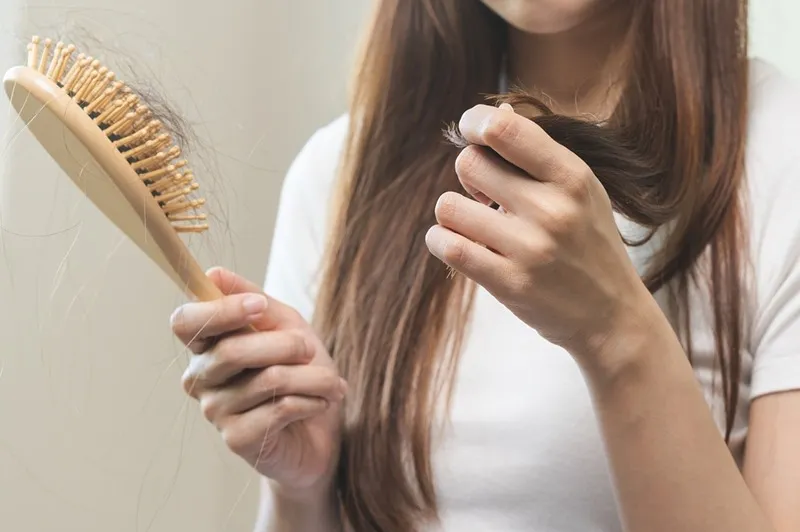 ریزش مو غیرطبیعی یکی از علائم عدم موفقیت کاشت مو است