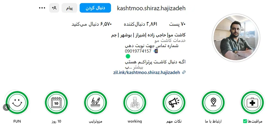 کاشت مو در بوشهر توسط اقای حاجی زاده کاملا قابل انجام است