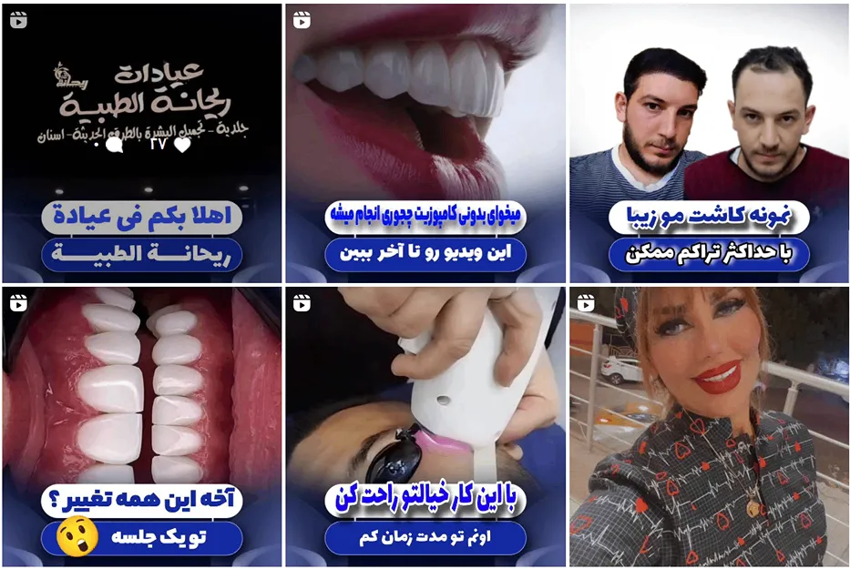 کاشت مو اقساطی در اهواز کاملا قابل اجرا است