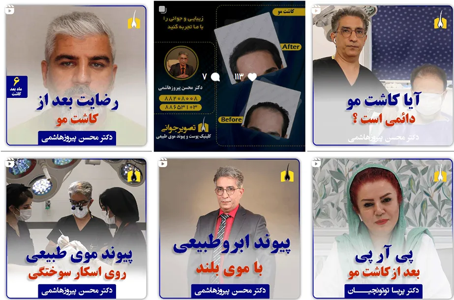 تصویر یکی از بهترین کلینیک کاشت مو در تهران را مشاهده میفرمایید.