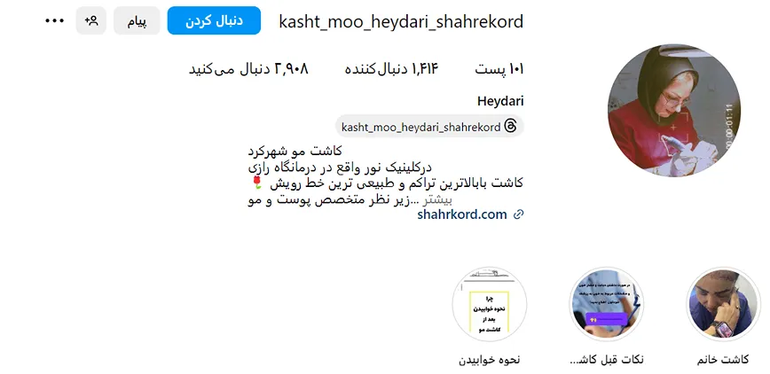 کاشت مو شهرکرد توسط خانم حیدری کاملا قابل انجام است