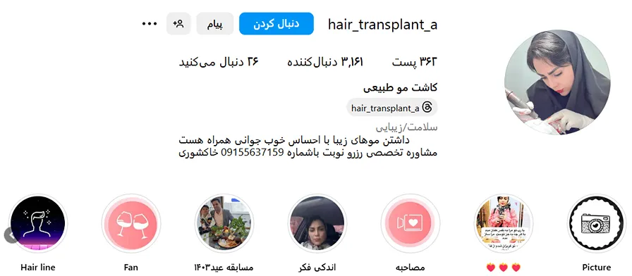 کاشت مو اقساطی در مشهد توسط دکتر خاکشوری کاملا قابل انجام است