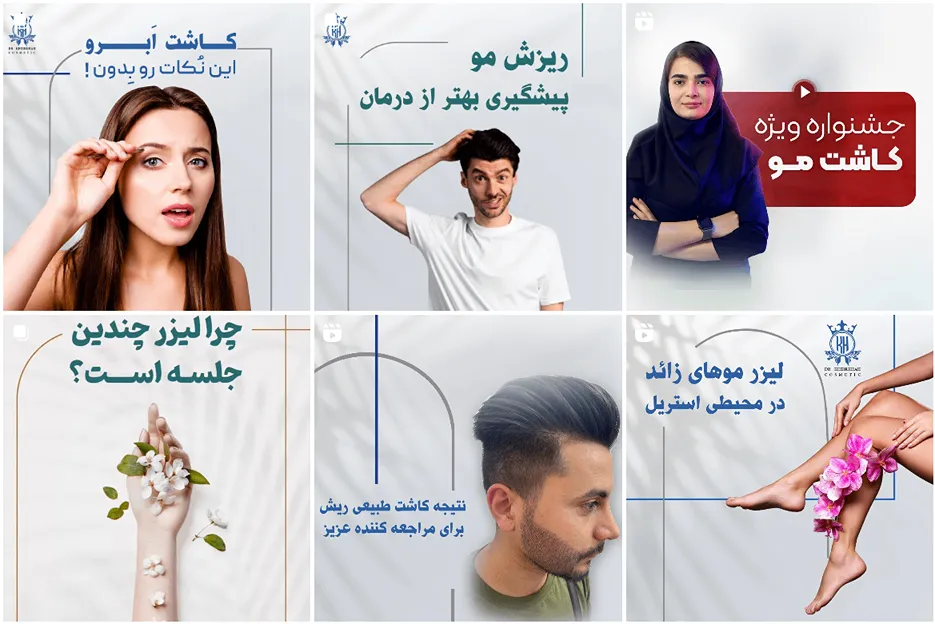 دکتر خیرخواه از بهترین دکتر کاشت مو در کاشان است