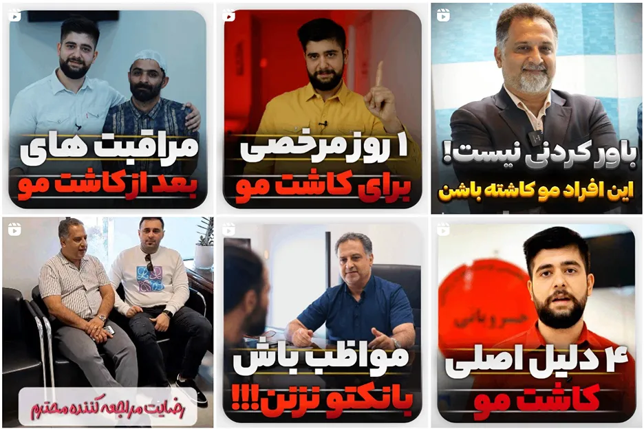 تصویر بهترین مراکز کاشت مو در تهران را مشاهده میفرمایید.