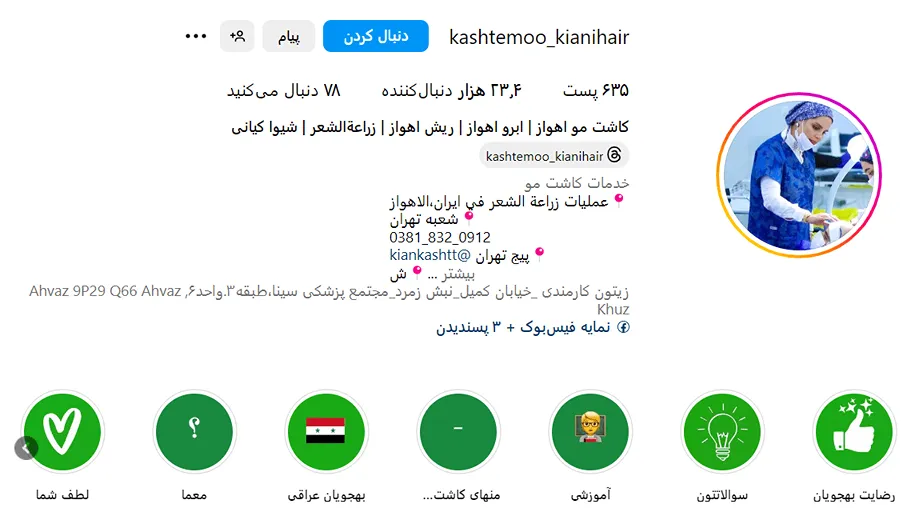 شیوا کیانی از بهترین دکتر کاشت مو در اهواز است