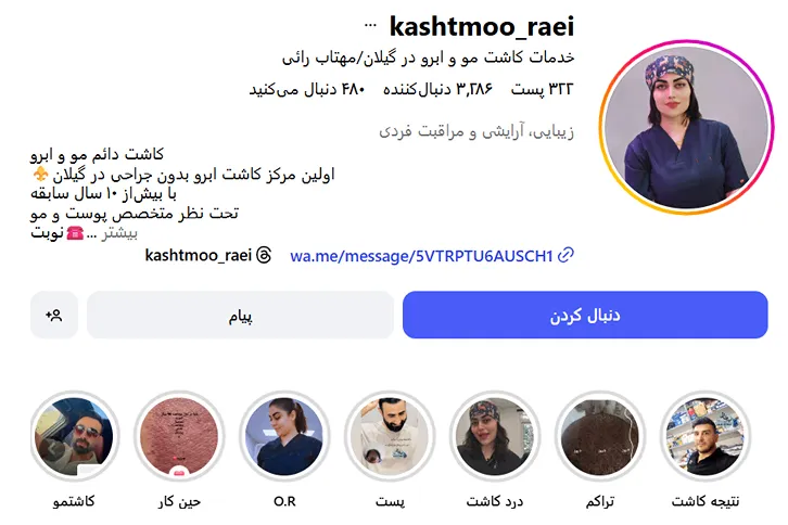 کاشت مو در رشت در کلینیک خانم رائی کاملا قابل انجام است