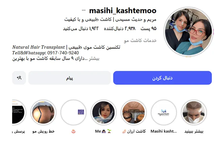 خانم حدیثی از بهترین دکتر کاشت مو در بندرعباس است