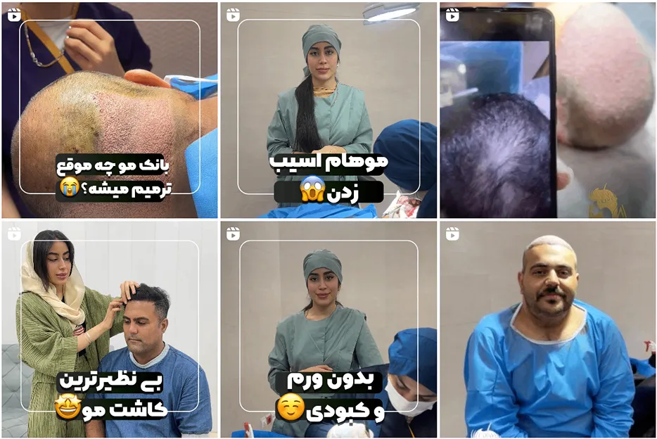 تصویر یکی از بهترین کلینیک کاشت مو در کاشان را مشاهده میفرمایید.