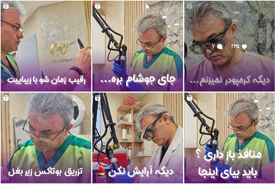 کاشت مو اهواز در کلینیک کاشت مو صدف کاملا قابل انجام است