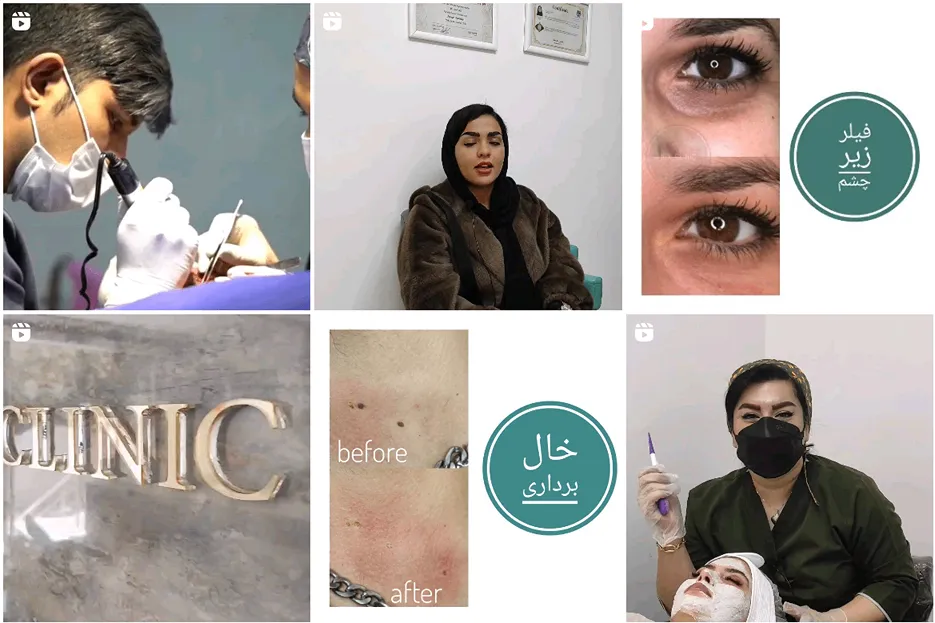 تصویر یکی از بهرتین مرکز کاشت مو در شیراز را مشاهده میفرمایید.