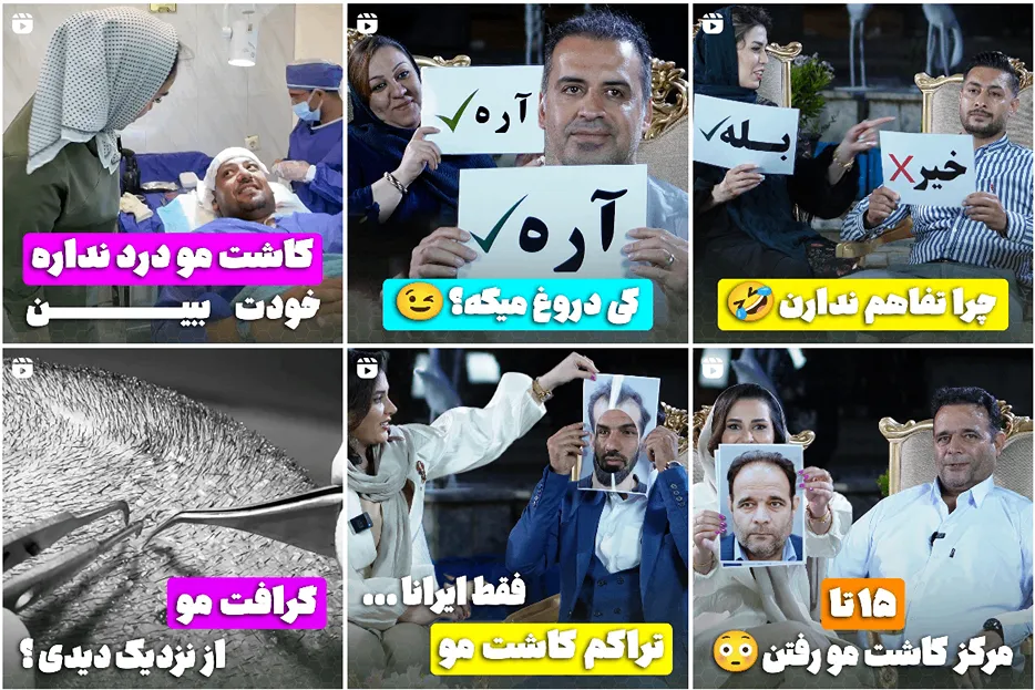 کلینیک نوین ایرانا از بهرتین کلینیک کاشت مو اقساطی در مشهد است