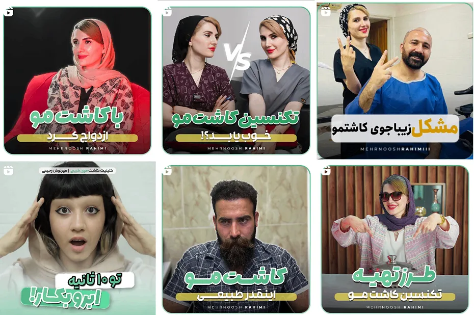 مهرنوش رحیمی یکی از بهترین دکتر کاشت مو در اهواز است