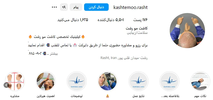کاشت مو در رشت توسط بهترین متخصصین و مراکز کاملا قابل انجام است