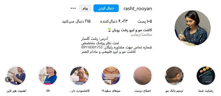 کاشت مو در رشت در کلینیک رویان کاملا قابل انجام است