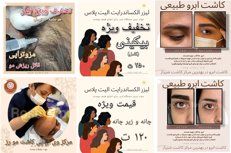 تصویر یکی از بهترین مرکز کاشت مو در شیراز را مشاهده میفرمایید.