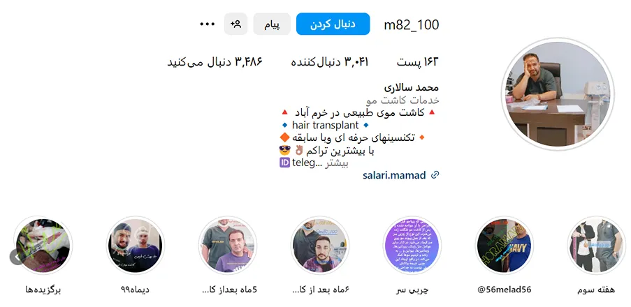 کاشت مو در خرم آباد توسط دکتر سالاری کاملا قابل انجام است