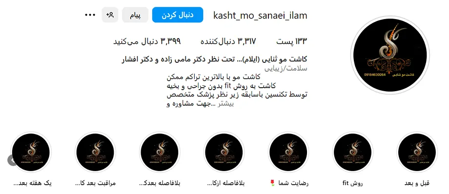 کاشت مو ایلام توسط تیم ثنایی کمالا قابل رزرو و انجام است