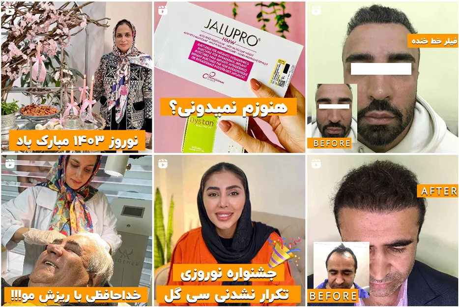 کاشت مو اقساطی مشهد توسط کلینیک سی گل صورت میپذیرد