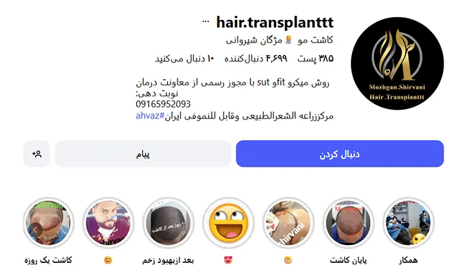 کاشت مو اهواز در کلینیک تخصصی خانم مژگان شیروانی کاملا قابل انجام است