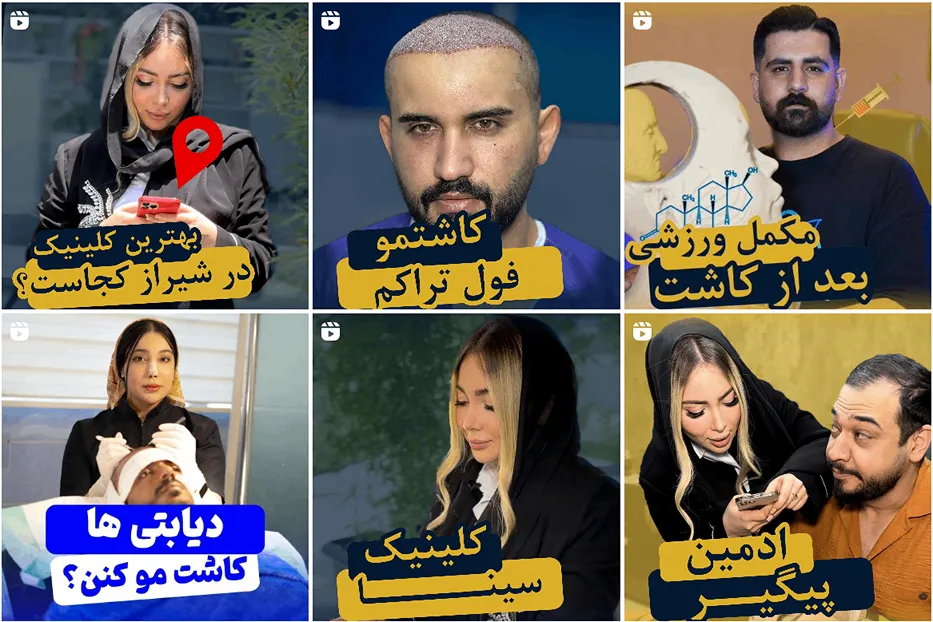 کلینیک سینا از بهترین کلینیک کاشت مو در شیراز است