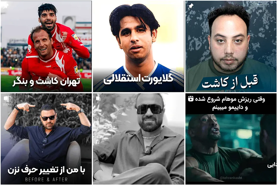 کلینیک تهران کاشت از بهترین کلینیک کاشت مو در تهران است