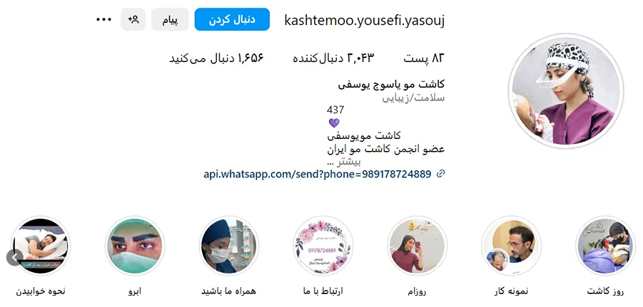 توصیر یکی از بهترین دکتر کاشت مو در یاسوج را مشاهده میفرمایید