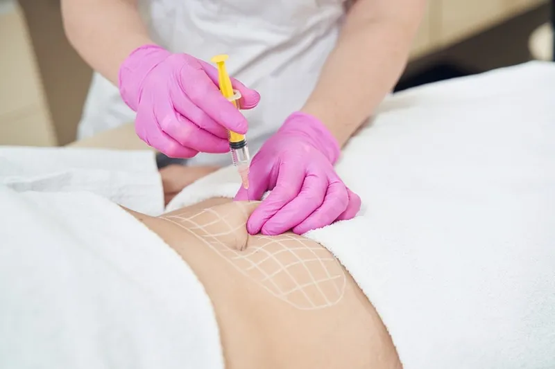 با انجام مزوتراپی لاغری، چربی های اضاغی ناحیه شکم را میتوان کاملا کاهش داد