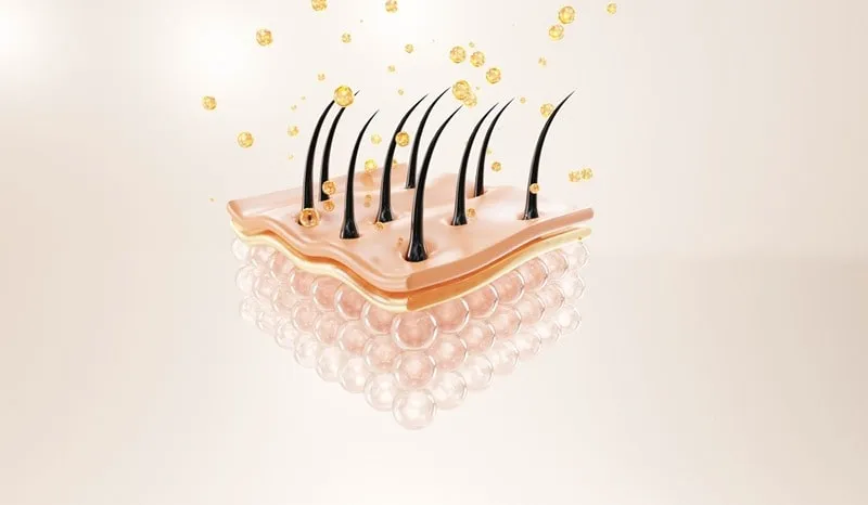از جمله فواید شستشو بعد از کاشت مو، از بین بردن چربی های اضافی در پوست سرذ است.