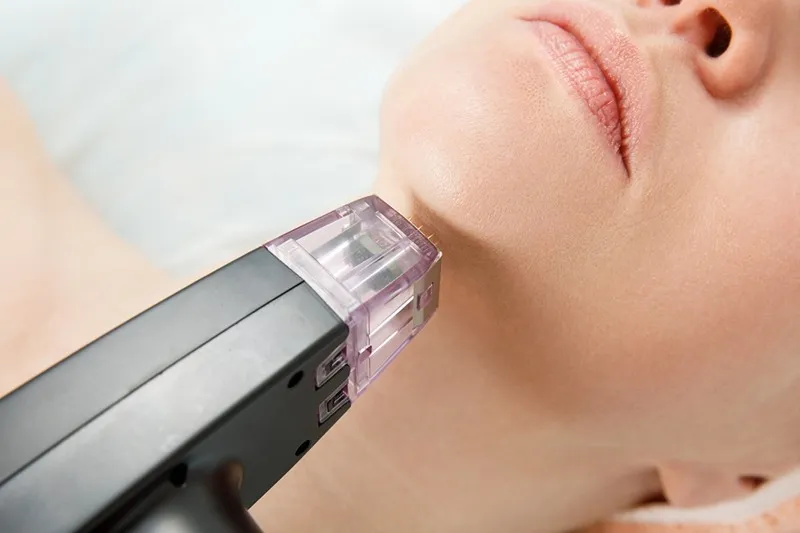 مزوتراپی غبغب با سر سوزن های مخصوص نیز انجام میشود.