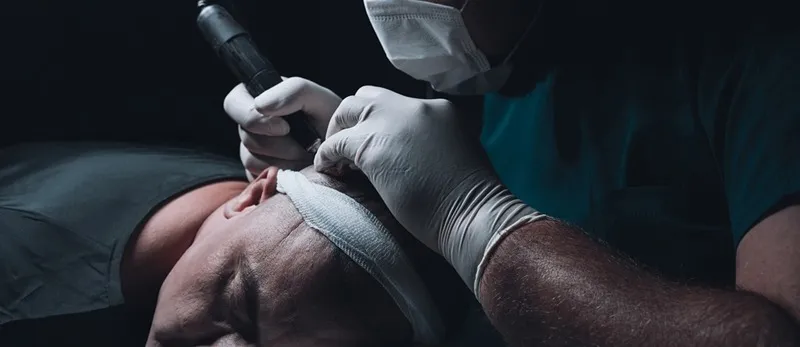 جدیدترین روش کاشت مو در مشهد شامل انواع مختلف کاشت است.