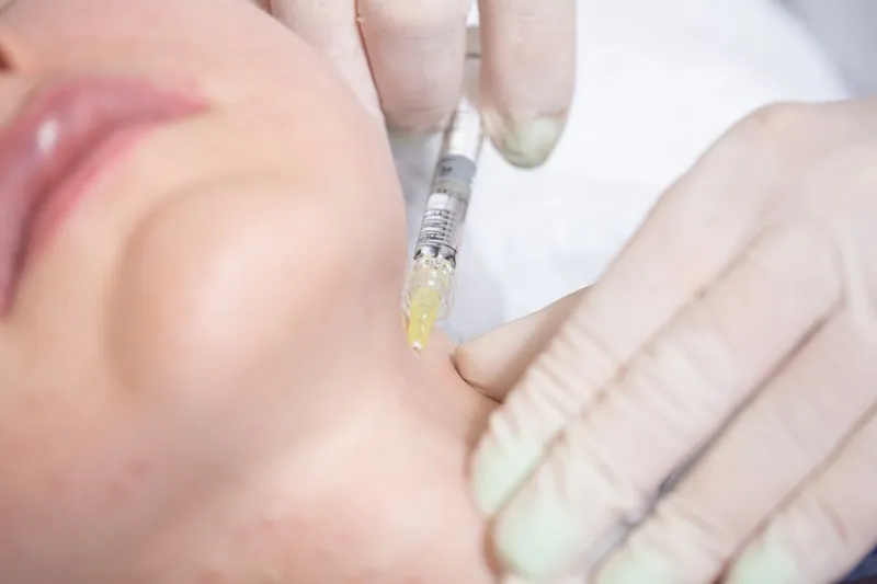 مزوتراپی غبغب یک روش بسیار ایمن و کاربردی درمانی است