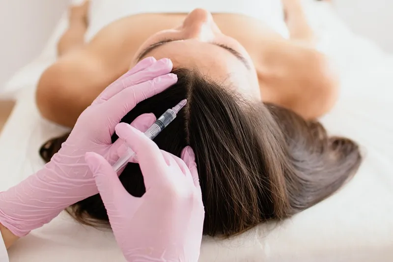 مراقبت های ویژه بعد از انجام مزوتراپی مو نقش مهمی را در کیفیت و نتیجه آن خواهند گذاشت