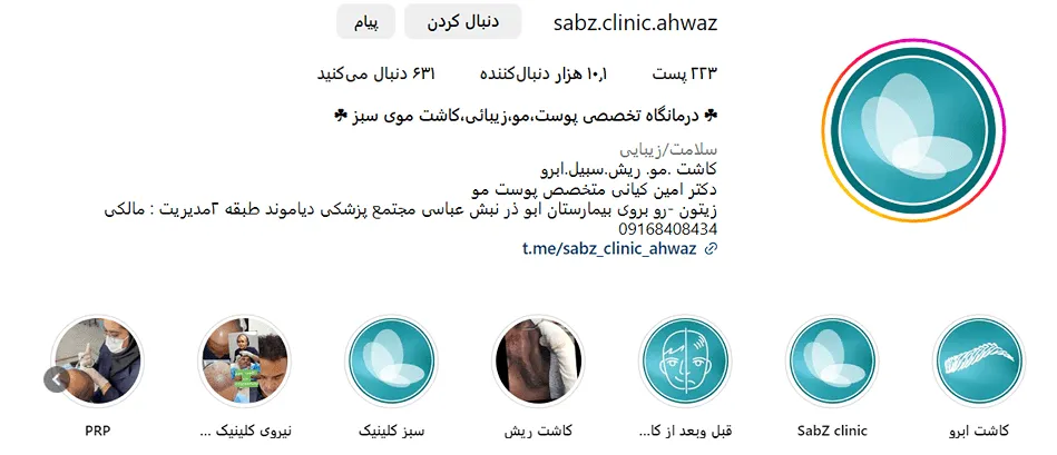 کاشت مو اقساطی در اهواز در هر کلینیک و مرکزی شرایط خاص خودش را دارد