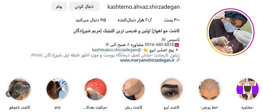 تصویر یکی از بهترین دکتر کاشت مو در اهواز را مشاهده میفرمایید.