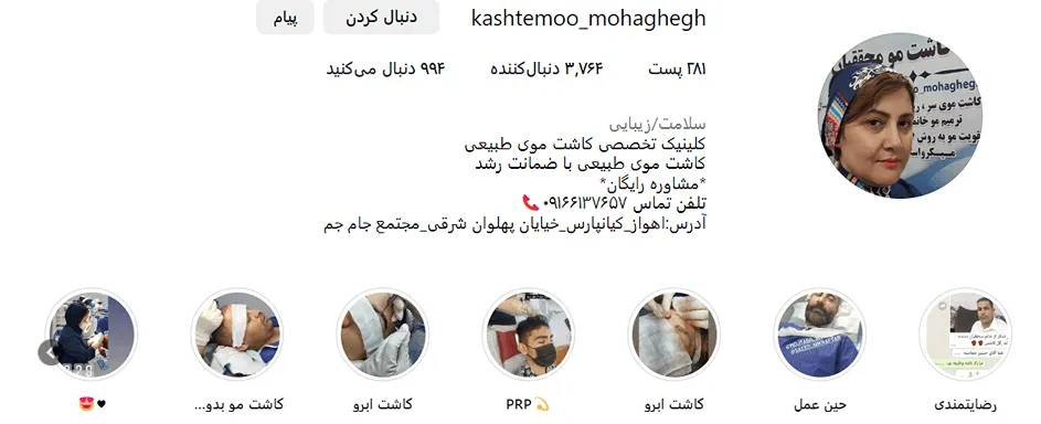 قیمت کاشت مو در اهواز نیز به عوامل متنوعی بستگی دارد.