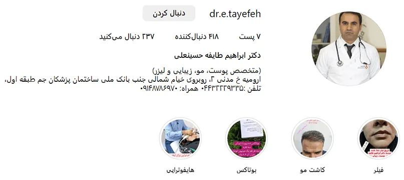 تصویر یکی از بهترین دکتر کاشت مو در ارومیه