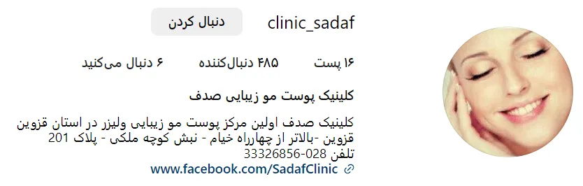 کاشت مو طبیعی در قزوین