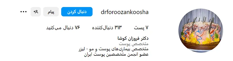 قیمت کاشت مو همدان نیز به عوامل زیادی مرتبط است